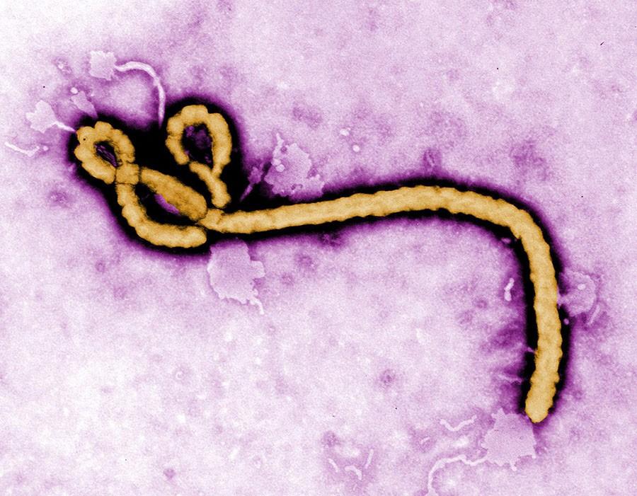 Ebola strand \\ The Ebola virus is transmitted to humans by wild animals and preads through communities by human contact. The fatality rate is approximately 50 percent. The incubation period is 2-21 days. Symptoms include fever, fatigue, muscle pain, vomiting, diarrhea and in some cases internal and external bleeding. 